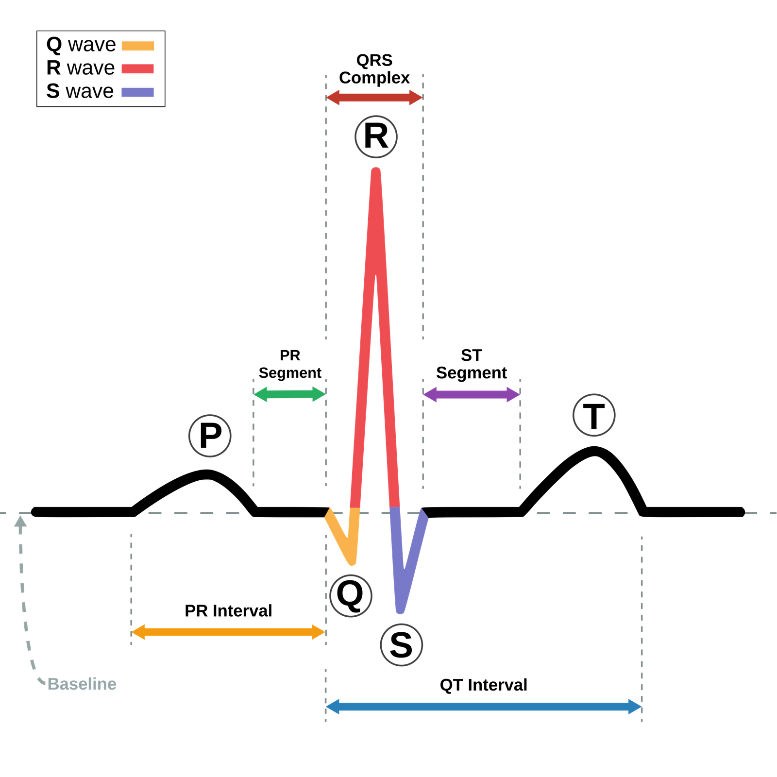 Detailed ECG Diagram showing P, Q, R, S, T waves
